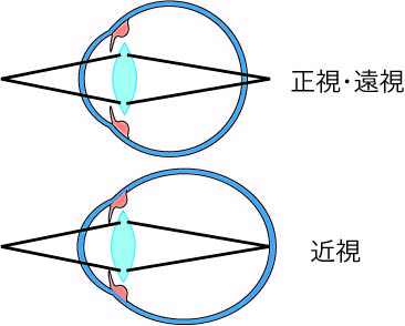 近方視小